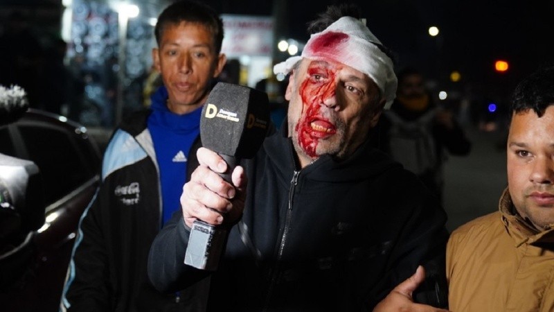 Un periodista recibió un botellazo en la cabeza durante el acto de La Libertad Avanza en Moreno