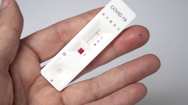 Autotest de coronavirus: cómo se notificarán los resultados