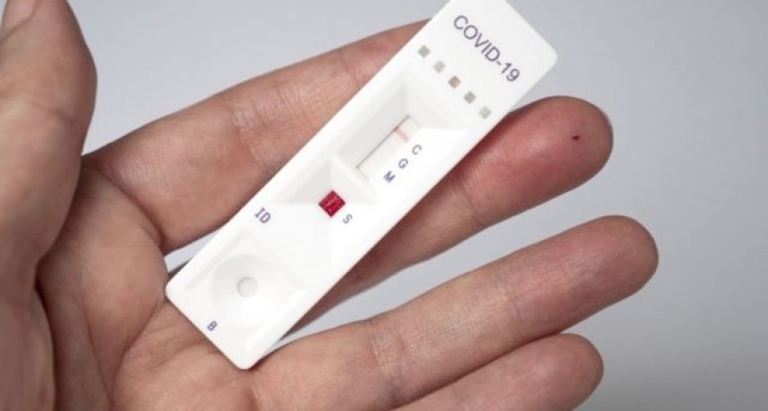 Autotest de coronavirus: c&oacute;mo se notificar&aacute;n los resultados