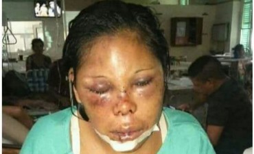 Una mujer fue brutalmente agredida en Helvecia