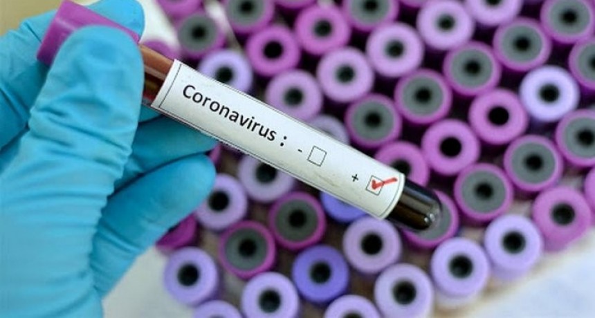 Primer caso de Coronavirus en Argentina