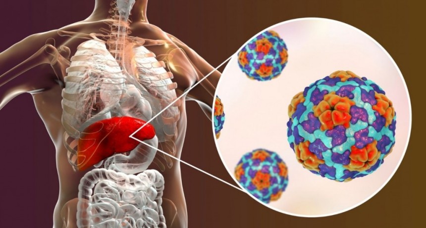 Hepatitis aguda grave: investigan ocho casos sospechosos