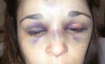 San Luis: una mujer recibió una brutal golpiza por parte de su pareja y ahora lucha por su vida