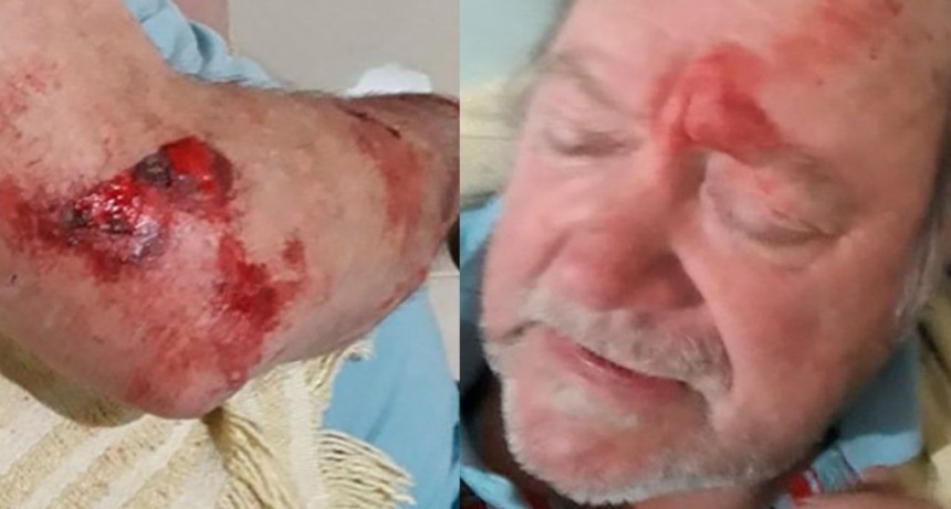 El descargo del jubilado que mat&oacute; al ladr&oacute;n: "No nac&iacute; para matar