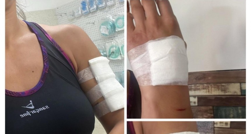 Otro caso m&aacute;s: una mujer fue atacada por un perro mientras corr&iacute;a