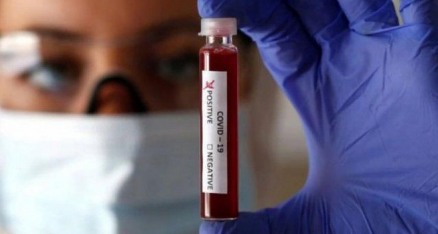 Coronavirus, 11 casos en Monte Vera y seis en la ciudad de Santa Fe 