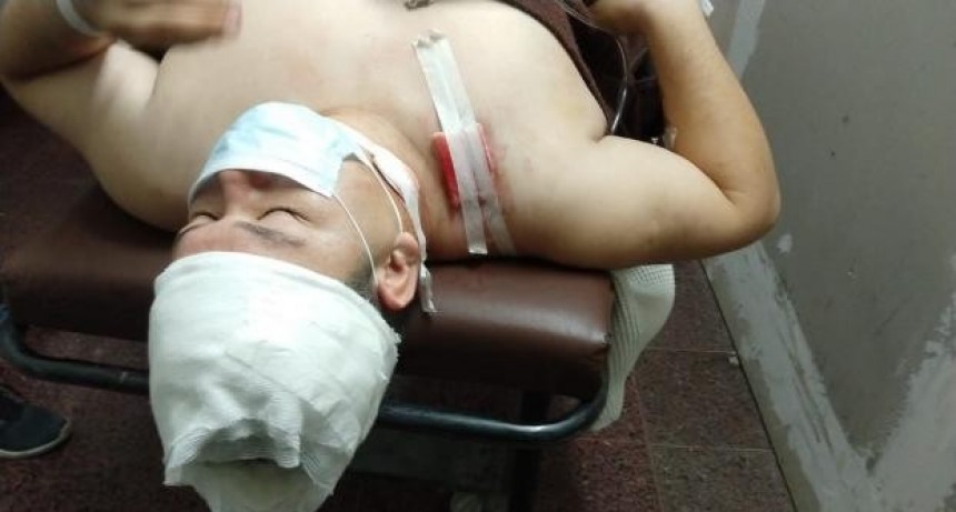 Robaron a un remisero y le dispararon tres veces en el norte de la ciudad