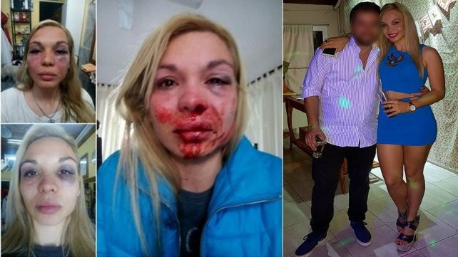 Una personal trainer fue desfigurada a golpes por su pareja