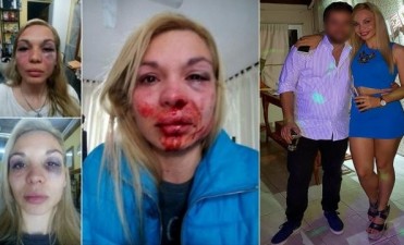 Una personal trainer fue desfigurada a golpes por su pareja