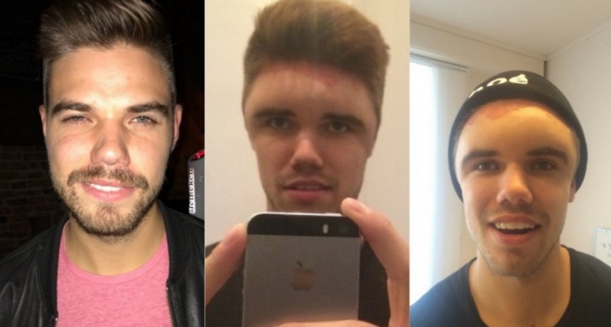 Se ti&ntilde;&oacute; el pelo y tuvo una brutal reacci&oacute;n al&eacute;rgica