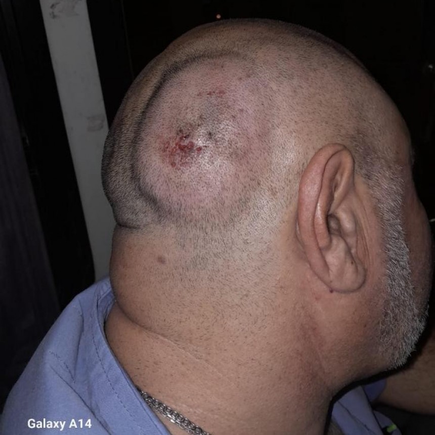 Chofer de la L&iacute;nea 16 fue brutalmente agredido con una piedra