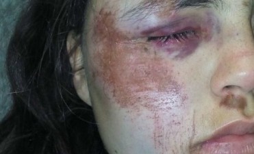 Violó la perimetral y con otros tres hombres golpeó a su ex